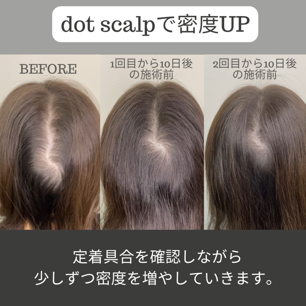 頭皮に描くヘアアートメイクで薄毛のお悩みを解消しませんか？ヘアアートメイクは痛みやダウンタイムはありません。近くで見ても本当の毛根にしか見えない自分の髪のような自然な仕上がりです。北陸金沢富山福井でヘアアートメイクするなら.SCALP（ドットスカルプ）で。